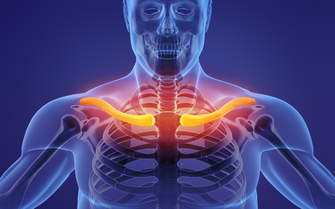 Complications in ports: pinch off syndrome