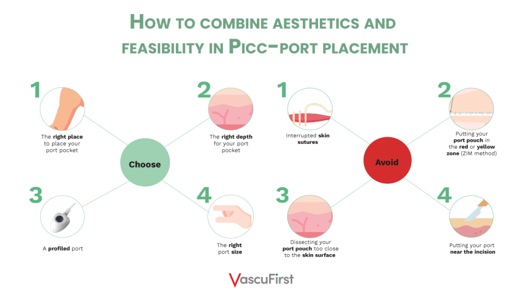 How to combine aesthetics and feasibility in picc-port placement