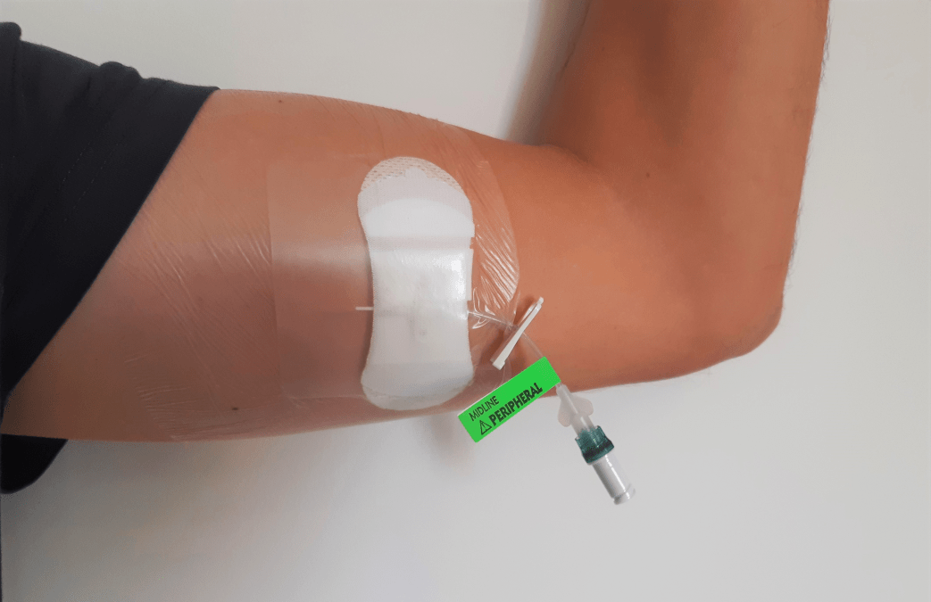 Midline catheter: placement and maintenance protocol