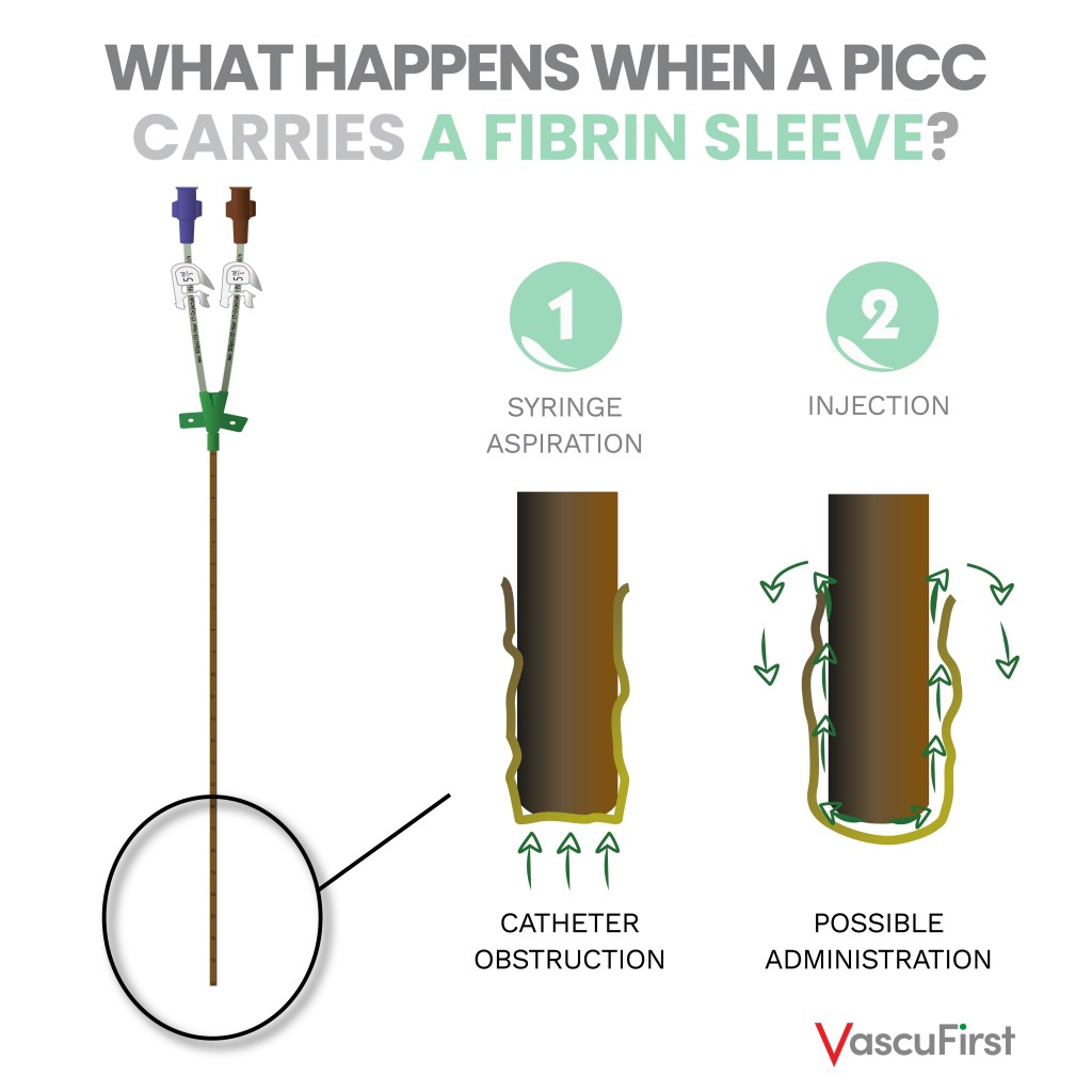 What happens when a PICC carries a fibrin sleeve