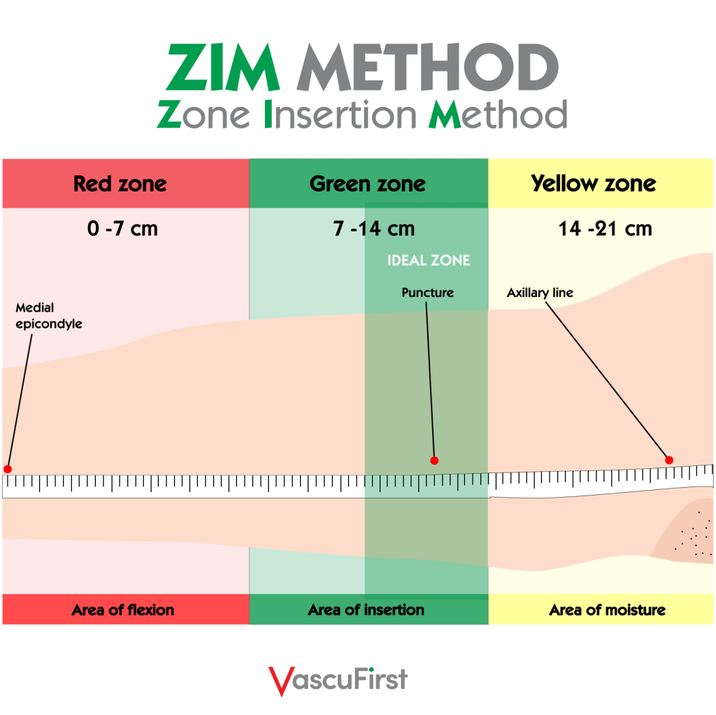 ZIM method