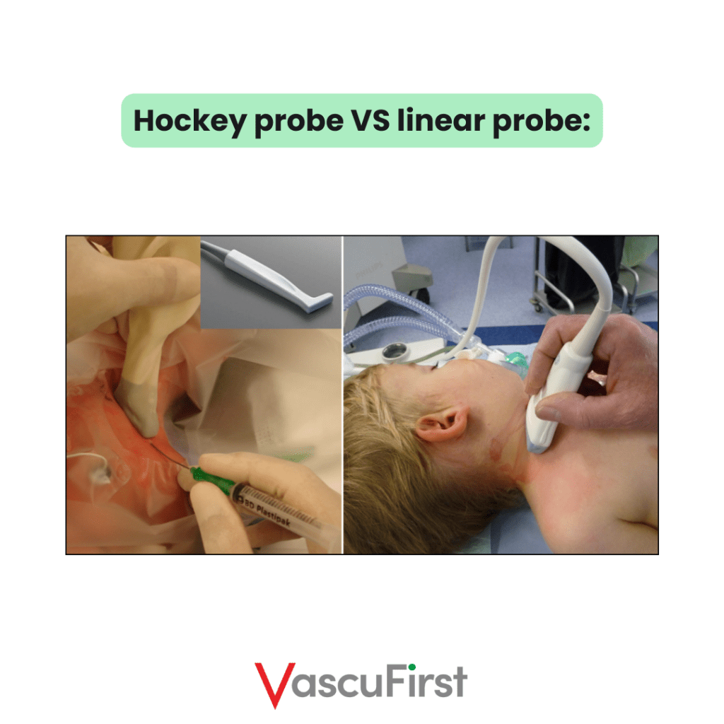 Hockey probe VS linear probe